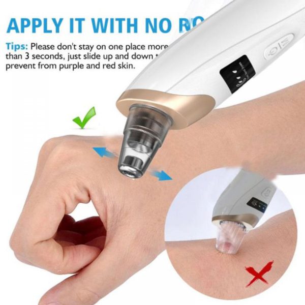 Blackhead Remover Vacuum β Suction Head Close-Up β BeautiVox Pakistan