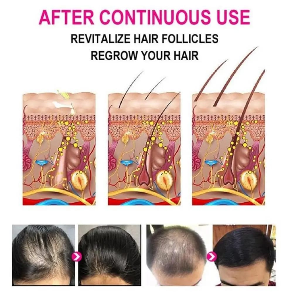 Anti-Grey Hair Serum – Darker Hair Color Results