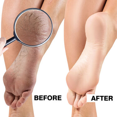 Best Foot Filer Pakistan – Woman Using Foot Filer at Home – BeautiVox Pakistan