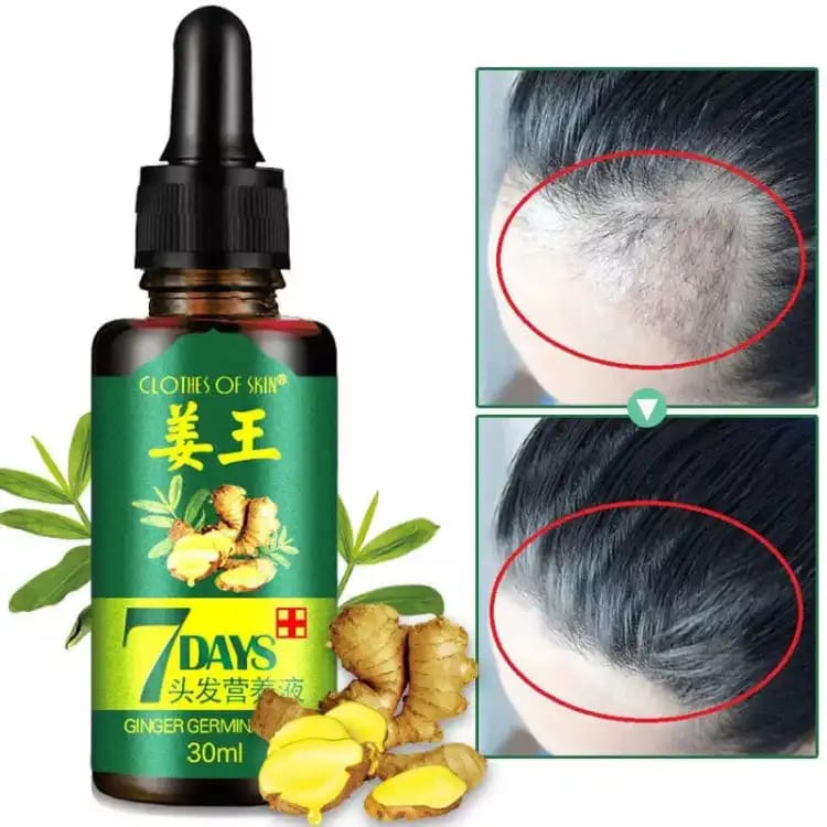 Hair Growth Serum – Thicker Regrown Hair Results – BeautiVox Pakistan